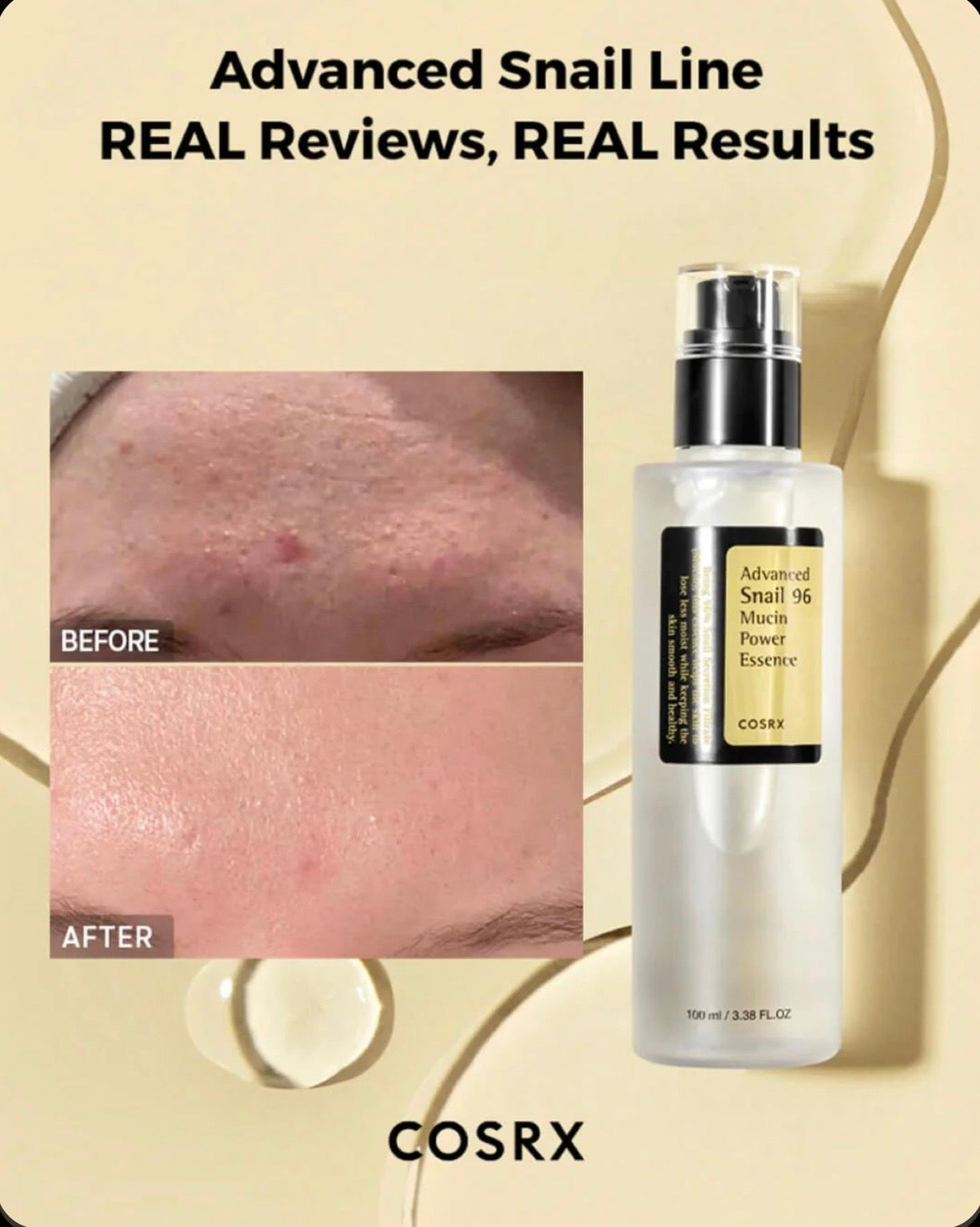 COSRX Snail 96 Mucin Power Essence – Essence Éclat & Hydratation